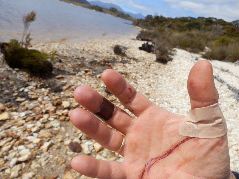 Wounds from Bushfighting