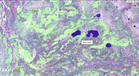 #4: Landsat-7 satellite image (August, 2001)